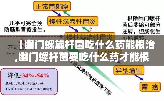 【幽门螺旋杆菌吃什么药能根治,幽门螺杆菌要吃什么药才能根治】