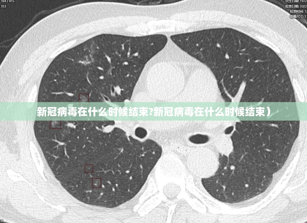 新冠病毒在什么时候结束?新冠病毒在什么时候结束）