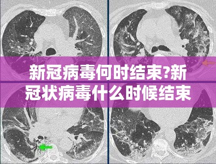 新冠病毒何时结束?新冠状病毒什么时候结束?