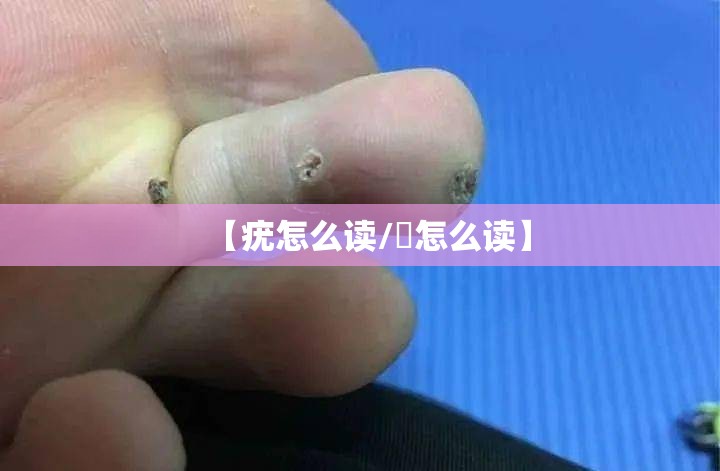 【疣怎么读/痏怎么读】