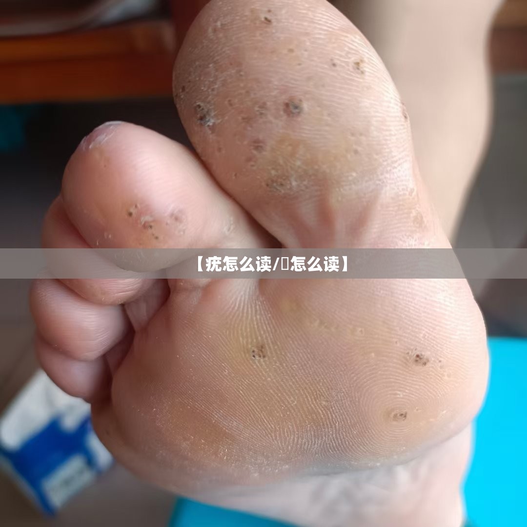 【疣怎么读/痏怎么读】