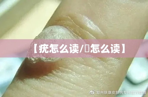 【疣怎么读/痏怎么读】