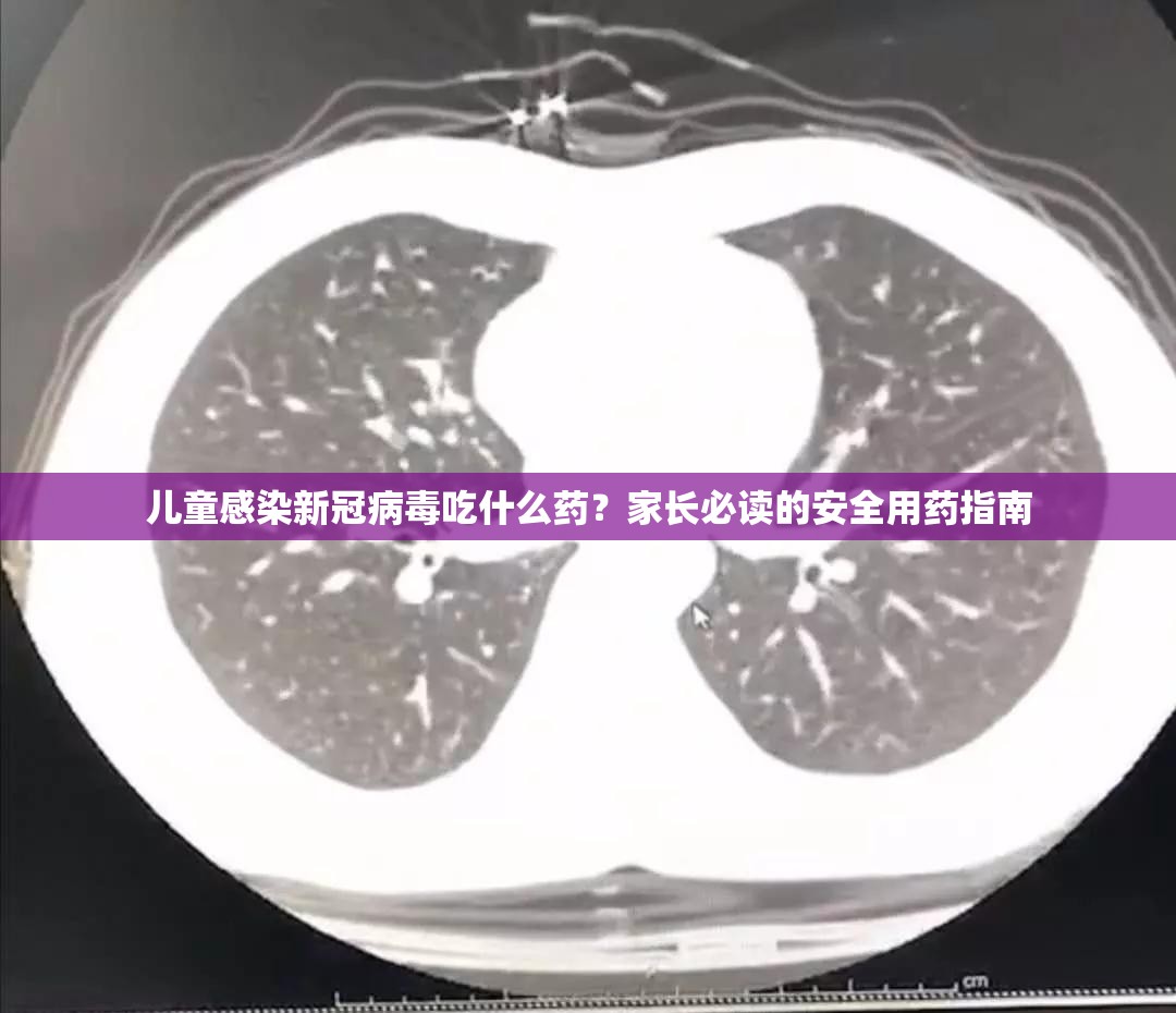 儿童感染新冠病毒吃什么药？家长必读的安全用药指南