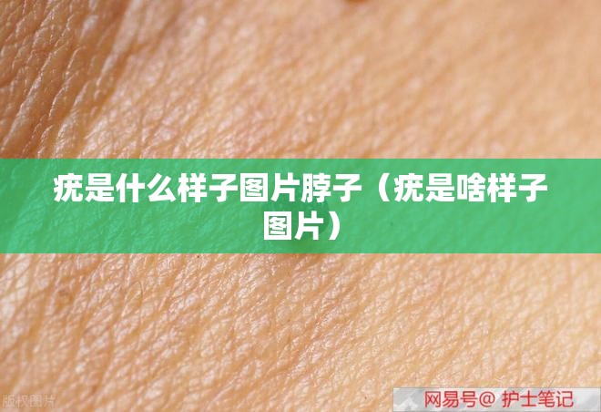 疣是什么样子图片脖子（疣是啥样子图片）