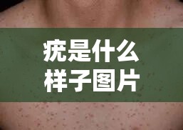 疣是什么样子图片脖子（疣是啥样子图片）