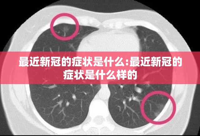 最近新冠的症状是什么:最近新冠的症状是什么样的