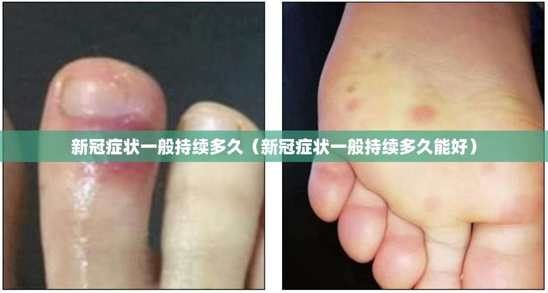 新冠症状一般持续多久（新冠症状一般持续多久能好）