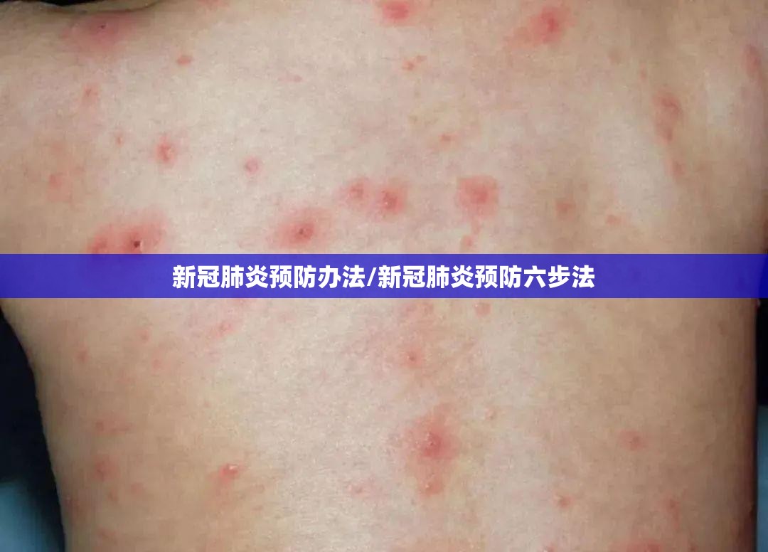 新冠肺炎预防办法/新冠肺炎预防六步法