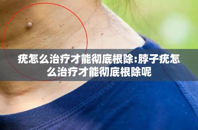 疣怎么治疗才能彻底根除:脖子疣怎么治疗才能彻底根除呢