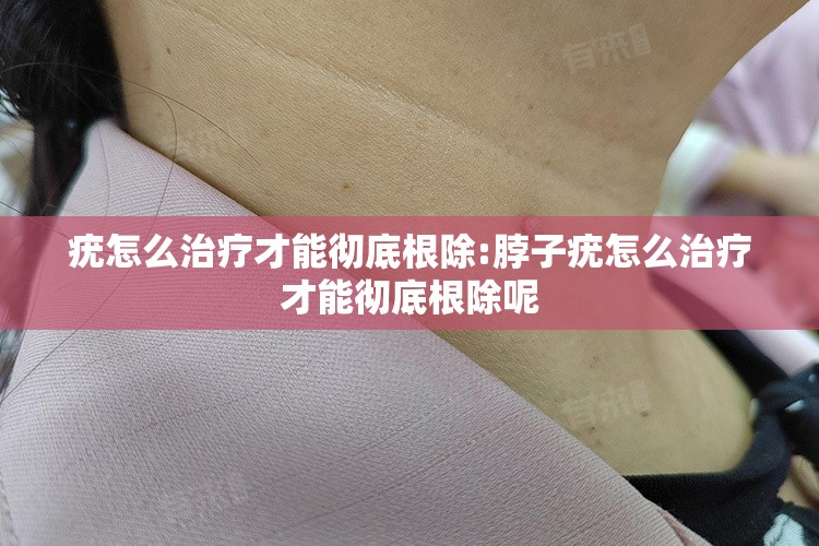 疣怎么治疗才能彻底根除:脖子疣怎么治疗才能彻底根除呢