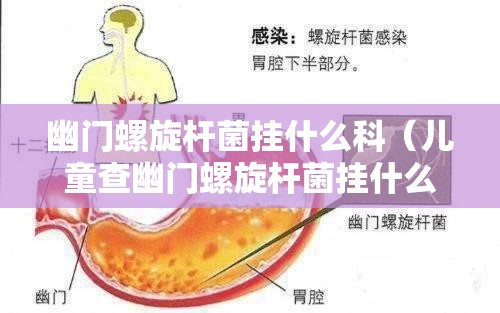 幽门螺旋杆菌挂什么科（儿童查幽门螺旋杆菌挂什么科）