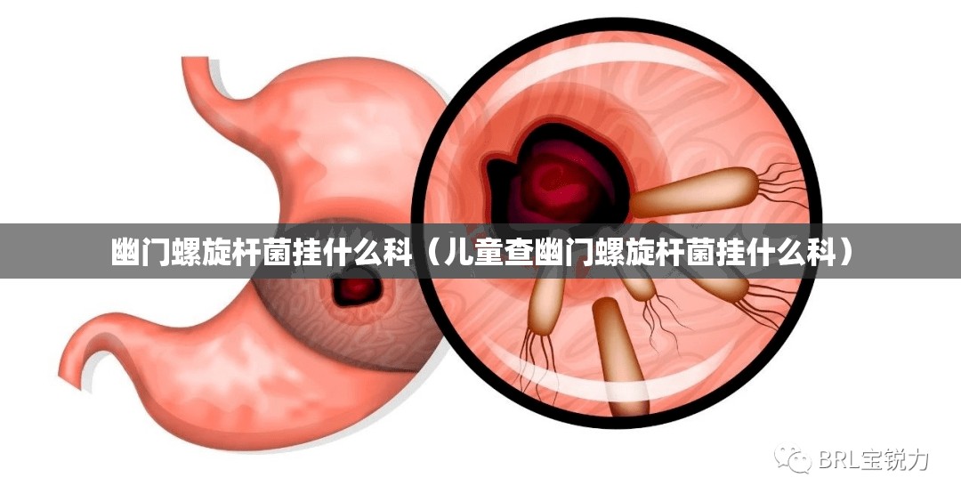 幽门螺旋杆菌挂什么科（儿童查幽门螺旋杆菌挂什么科）