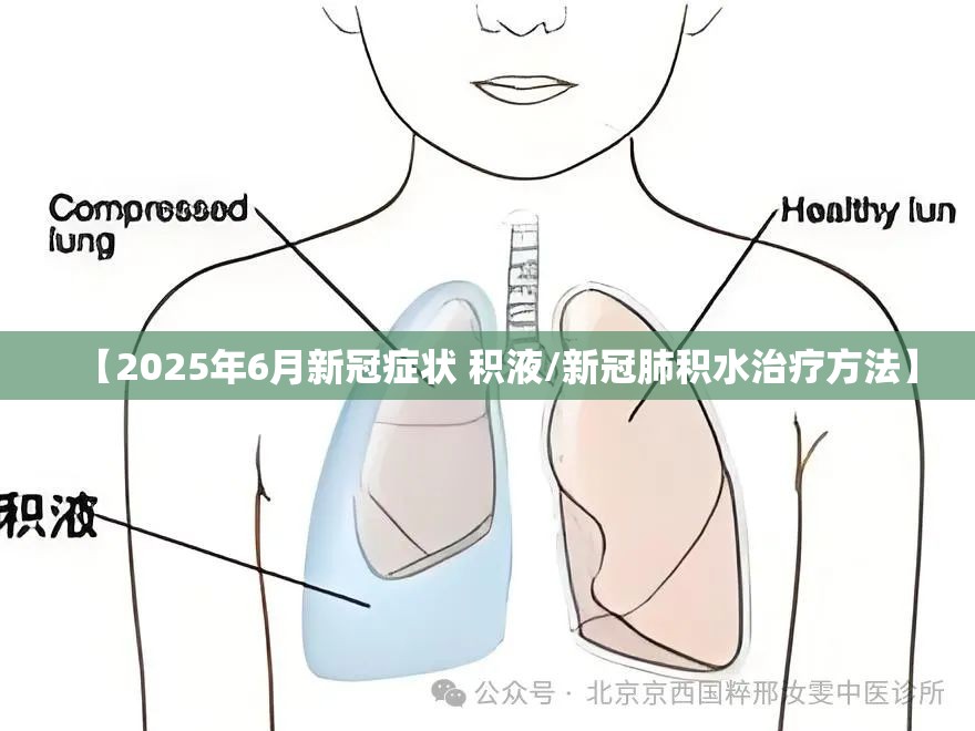 【2025年6月新冠症状 积液/新冠肺积水治疗方法】