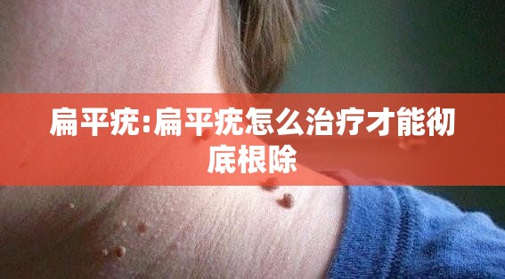 扁平疣:扁平疣怎么治疗才能彻底根除