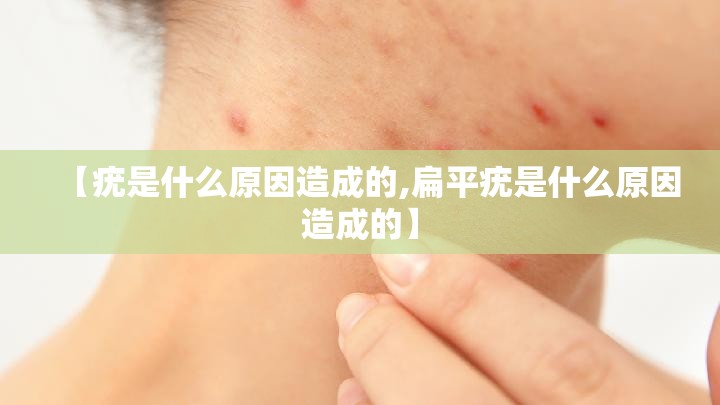 【疣是什么原因造成的,扁平疣是什么原因造成的】